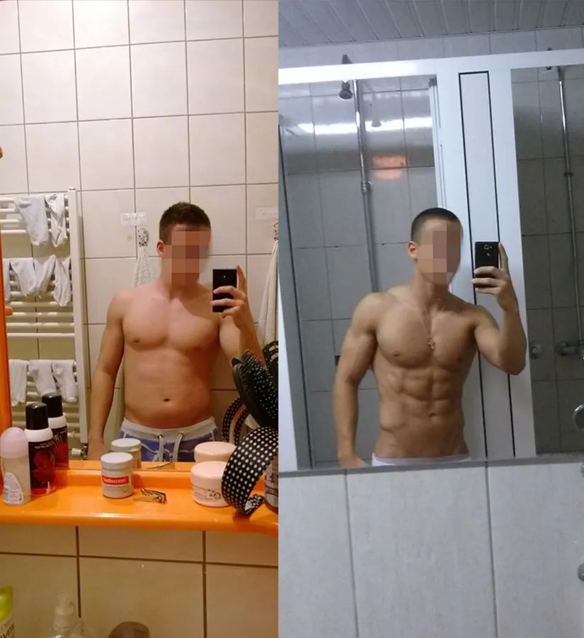 Miloš S., pre i posle (1/2)