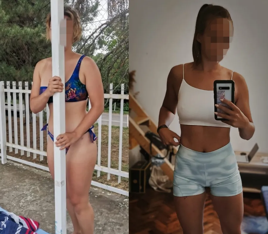 Tijana S., pre i posle